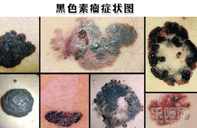 图片11.jpg